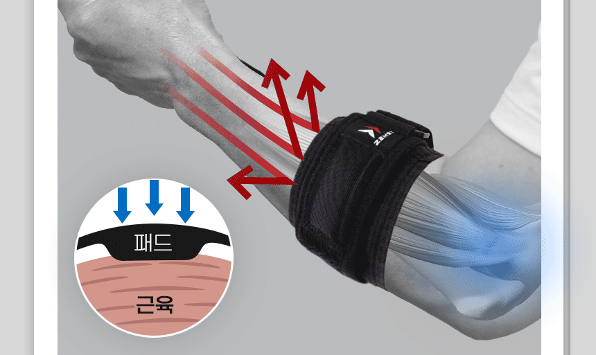  ELBOW BAND
